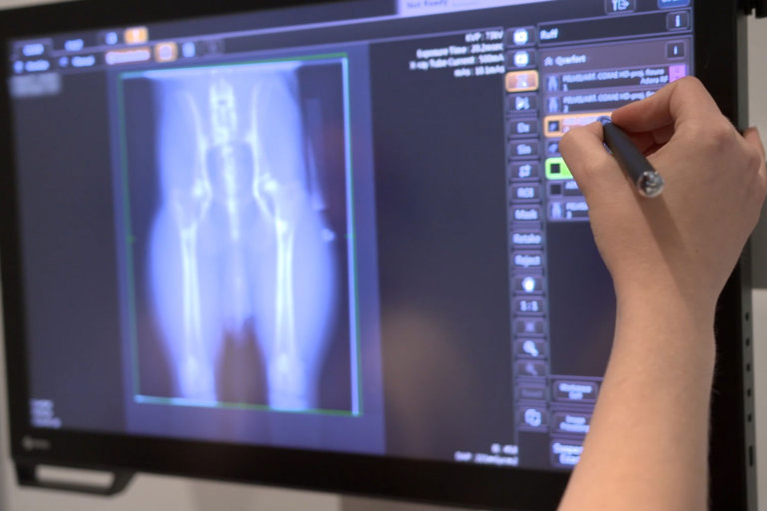 röntgenavläsare ser på röntgenbild