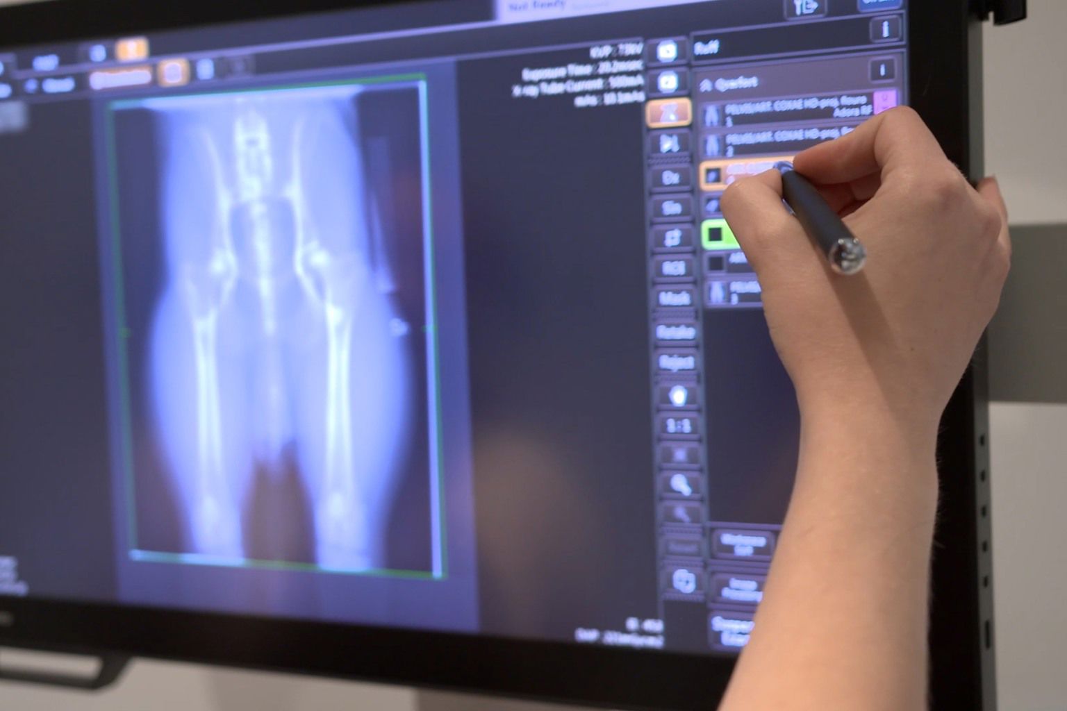 x-ray 